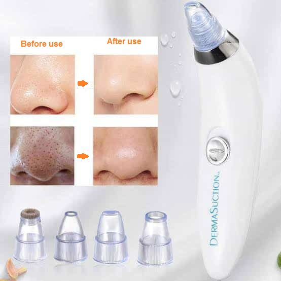 3 in 1 Derma Suction – Blackhead Remover & Pore Cleaner | ChinaCart.pk