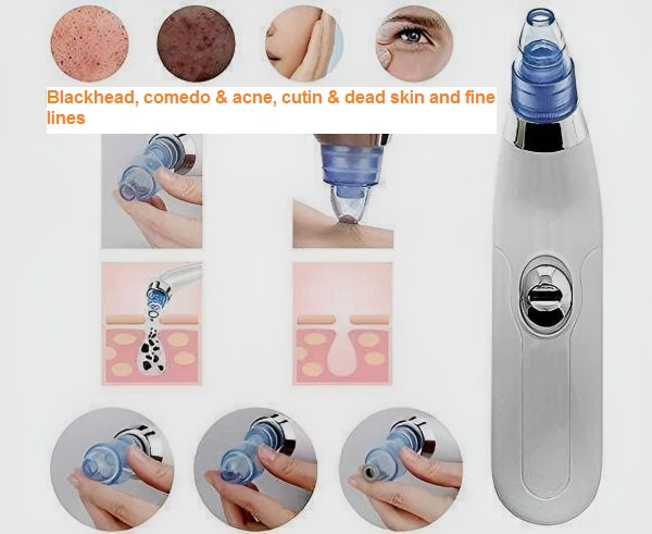 3 in 1 Derma Suction – Blackhead Remover & Pore Cleaner | ChinaCart.pk