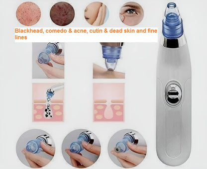 3 in 1 Derma Suction – Blackhead Remover & Pore Cleaner | ChinaCart.pk