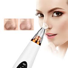 3 in 1 Blackhead Remover – Pore Cleaner & Facial Vacuum Tool | ChinaCart.pk