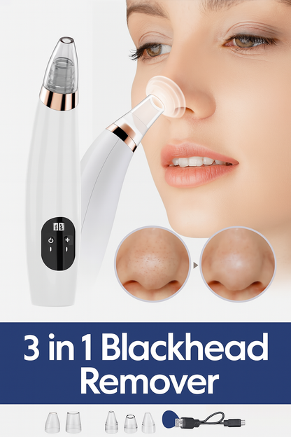 3 in 1 Blackhead Remover – Pore Cleaner & Facial Vacuum Tool | ChinaCart.pk