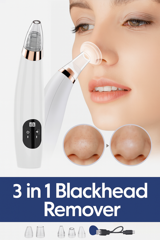 3 in 1 Blackhead Remover – Pore Cleaner & Facial Vacuum Tool | ChinaCart.pk